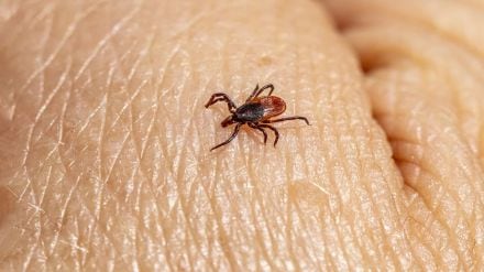 Crimean-Congo hemorrhagic fever, Crimean-Congo hemorrhagic fever virus, Ebola virus, bleeding eyes disease, Crimean-Congo hemorrhagic fever death, health news, wellness news,