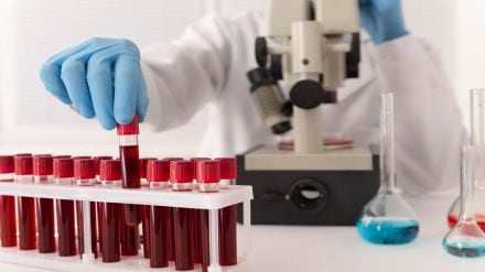Cholesterol tests, bad cholesterol, good cholesterol, Lipid profile test, Lipid panel test, health news, wellness news,