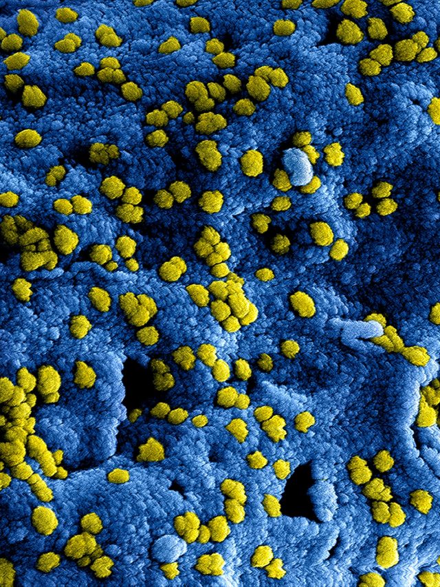 pexels-cdc-library-3992937