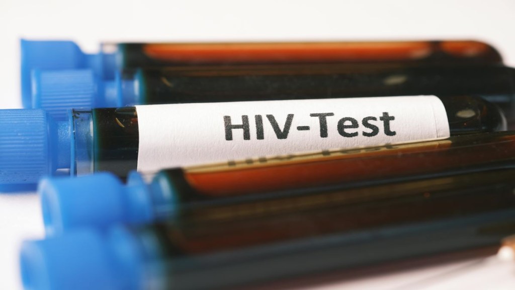 HIV, HIV in Tripura, HIV cases in Tripura, HIV in students, healthcare news,