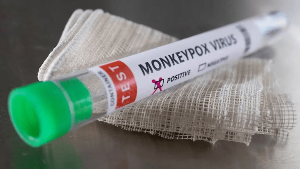 Mpox Mpox