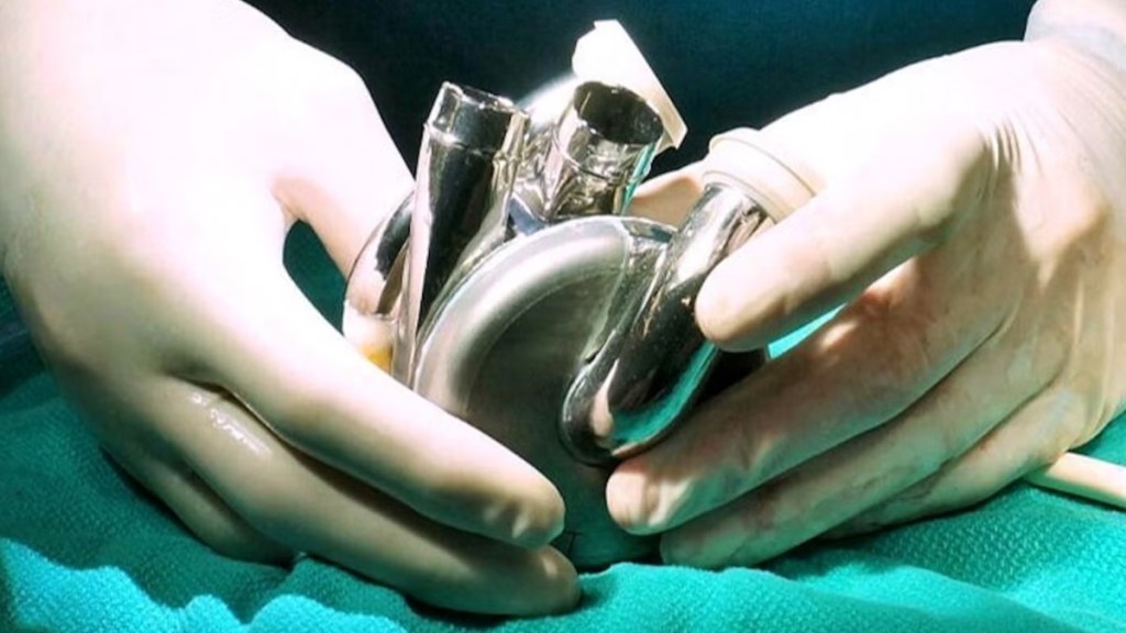 metal heart, titanium heart, US man heart, heart, fake heart, health, healthtech, us man gets metal heart