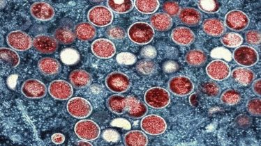 India confirms first case of fast-spreading mpox clade 1b variant