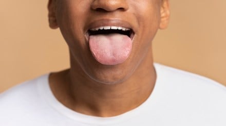 oral health, clean mouth, clean tongue, tongue health, oral care, health news, wellness news,