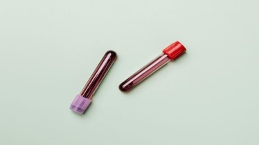 Blood-based biomarker tests the new frontier for Alzheimer’s diagnosis: GlobalData