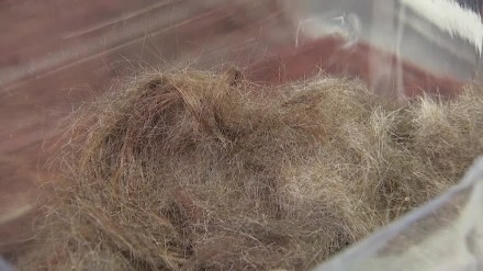 Bareilly, Bareilly news, UP, UP news, Uttar Pradesh, Uttar Pradesh news, woman eats hair, what is trichophagia, trichophagia, trichophagia news