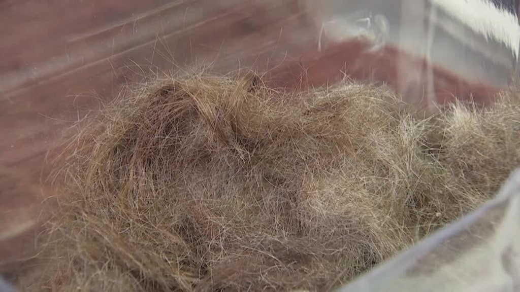 Bareilly, Bareilly news, UP, UP news, Uttar Pradesh, Uttar Pradesh news, woman eats hair, what is trichophagia, trichophagia, trichophagia news