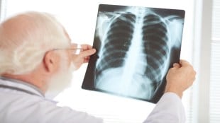 Tuberculosis, Tuberculosis impact, Lung health, Diabetes, Liver Function, Liver health, health news, wellness news,