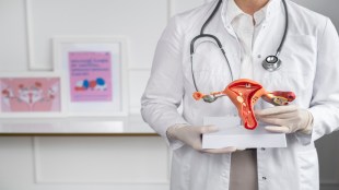 Common myths about PCOS: