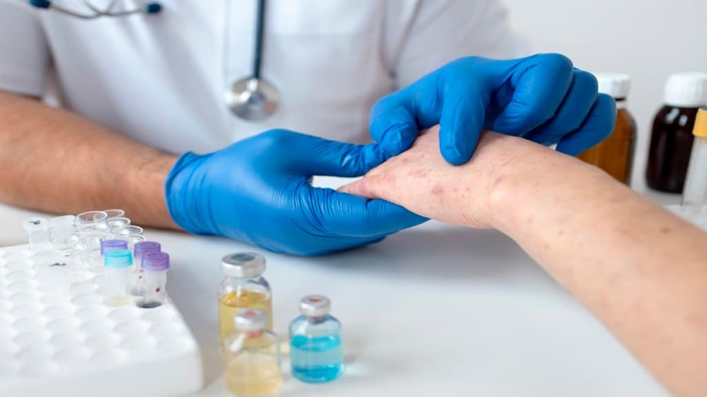 Chickenpox, chickenpox symptoms, chickenpox treatment, Adult chickenpox, health news, wellness news,