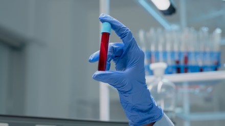 Suraksha Diagnostics IPO Date, Price Band, GMP, Review, Key Factors and More