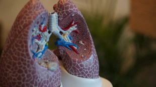 Heart attack risk from pneumonia