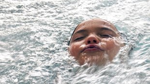 Acanthamoeba keratitis, Acanthamoeba keratitis symptoms, Acanthamoeba keratitis causes, Acanthamoeba keratitis treatment, contact lenses, contact lenses side effects, swimming, health news, wellness news,