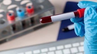 Metropolis Healthcare acquires Core Diagnostics to enhance capabilities in advanced cancer testing