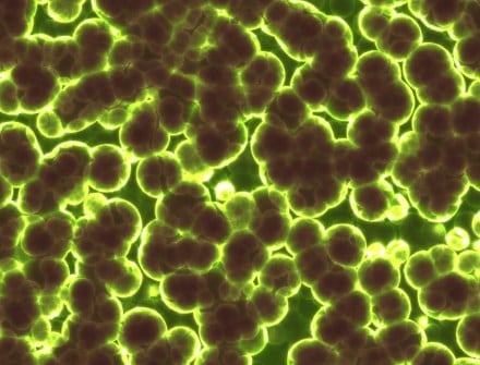 Beware looking into this mirror: It could eat you up, scientists warn of lab-made 'mirror bacteria'