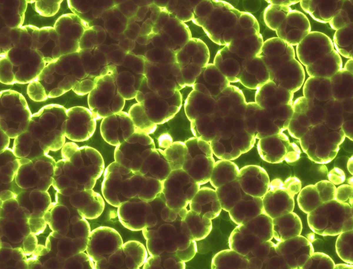Beware looking into this mirror: It could eat you up, scientists warn of lab-made 'mirror bacteria' Beware looking into this mirror: It could eat you up, scientists warn of lab-made 'mirror bacteria'