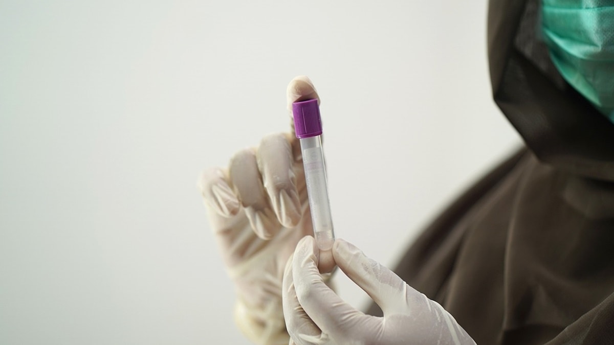 ICMR Licenses RT-PCR Kit to Molbio Diagnostics for accurate diagnosis of multiple enteric viruses