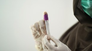 ICMR Licenses RT-PCR Kit to Molbio Diagnostics for accurate diagnosis of multiple enteric viruses