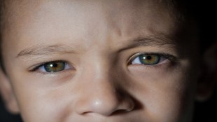 Myopia, Myopia air pollution, Myopia symptoms, air pollution effect, air pollution health impact, health news, wellness news,
