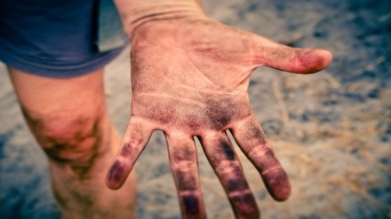 Lead poisoning, lead poisoning in children, lead poisoning in adults, lead poisoning death, lead poisoning in india, health news, wellness news,