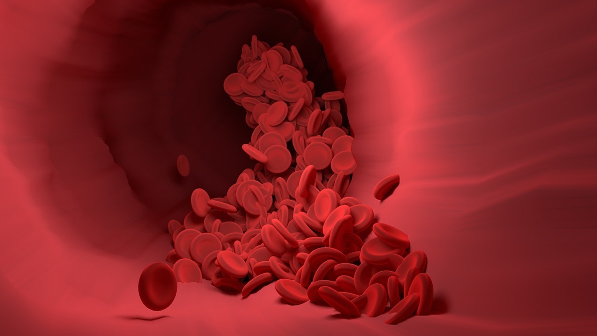First-in-human indigenous gene therapy for Hemophilia A shows significant positive outcomes First-in-human indigenous gene therapy for Hemophilia A shows significant positive outcomes