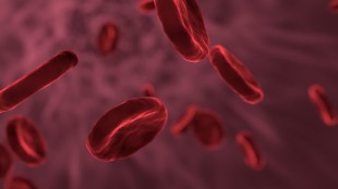 Is iron deficiency only cause of anaemia? New study reveals shocking details