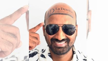 sahfeek hashim vlogs, 70mm vlogs, shafeek hashim densitae, baldness sahfeek hashim vlogs, 70mm vlogs, shafeek hashim densitae, baldness