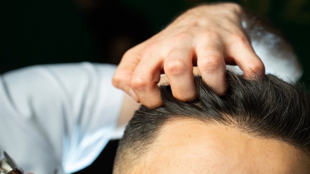 Baldness virus, baldness virus in Maharashtra, baldness virus Buldhana, baldness virus in India, baldness virus in Buldhana district, baldness virus news, baldness virus symptoms, baldness virus treatment, baldness virus in Hindi, is baldness a disease, baldness virus India, has baldness been cured, is there a cure for baldness yet, baldness and COVID, baldness and genetics, is baldness a sign of bad health, baldness virility, baldness caused by genetic and environmental factors, Buldhana baldness virus, will they ever find a cure for baldness, baldness disease causes, baldness disease, virus causing baldness, baldness disorder, is there no cure for baldness, why is there no cure for baldness Reddit, baldness epidemic, genetic baldness in males, hair baldness genetics, genes baldness, baldness in genetics, India baldness virus, what is baldness virus, is baldness contagious, is baldness genetics, baldness virus Maharashtra, is baldness curable, baldness meme, baldness mutation, Maharashtra baldness virus, male baldness symptoms, male baldness genetics, baldness news, baldness news 2022, baldness will never be cured, baldness vs alopecia, baldness passed down, is baldness reversible, is baldness more common today, is baldness harmful, is baldness a gene, the baldness virus, will there ever be a baldness cure, why is there no baldness cure, baldness war, baldness wiki, what diseases cause baldness, is baldness X-linked, X-linked baldness gene, zinc and baldness, health news, wellness news,