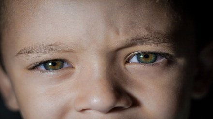 Myopia, myopia glasses, myopia eye, marketing myopia, high myopia, causes of myopia, myopia definition, what is the highest myopia, define myopia, causes of myopia class 10, can myopia be cured, myopia and astigmatism, myopia and hyperopia, myopia and presbyopia, myopia antonym, myopia and hypermetropia, myopia and intelligence, myopia adjustments, myopia and screen time, myopia and glaucoma, myopia and retinal detachment, astigmatism vs myopia, atropine eye drops for myopia, alcohol myopia, axial myopia, atropine for myopia control, astigmatism and myopia together, a person with myopia, acute myopia, alcohol myopia theory, antonym of myopia, myopia bilateral, myopia bilateral ICD 10, myopia bilateral meaning, myopia bilateral definition, myopia both eyes, myopia bilateral H52.13, myopia bilateral VA rating, myopia blindness, myopia bias, myopia baby, bilateral myopia, BHVI myopia calculator, both myopia and hypermetropia is called, best eye drops for myopia, bilat myopia, bilateral myopia ICD 10, best contact lenses for myopia, best myopia control lenses, bilateral myopia with astigmatism, be high myopia, myopia control, myopia causes, myopia control contact lenses, myopia control glasses, myopia cure, myopia can be described as, myopia calculator, myopia correction, myopia country club, myopia code, correction of myopia, can myopia be reversed, concave lens for myopia, cultural myopia, can myopia lead to blindness, congenital myopia, correction of myopia class 10, myopia Destiny 2, myopia def, myopia definition medical, myopia definition Lord of the Flies, myopia degree chart, myopia drops, myopia diagnosis code, myopia degeneration, myopia disease, difference between myopia and hypermetropia, degenerative myopia, definition of myopia, diagram of myopia, differentiate between myopia and hypermetropia, does myopia get worse with age, distinguish between myopia and hypermetropia, difference between myopia and hyperopia, define myopia class 10, myopia emblem Destiny 2, myopia eye drops, myopia eye condition, myopia epidemic, myopia eye shape, myopia etymology, myopia eyesight, myopia example, myopia economics, eye exercises for myopia, eye myopia, empty field myopia, explain myopia, eye myopia teeth, health news, wellness news,