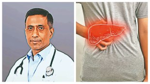 Dr Sudeep Khanna, senior consultant, gastroenterology, Indraprastha Apollo Hospitals. (Image Source: Financial express)