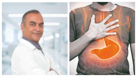 Dr Arun Prasad, senior consultant, gastroenterology and bariatric surgery, Indraprastha Apollo Hospitals. (Image Source: FE) Dr Arun Prasad, senior consultant, gastroenterology and bariatric surgery, Indraprastha Apollo Hospitals. (Image Source: FE)