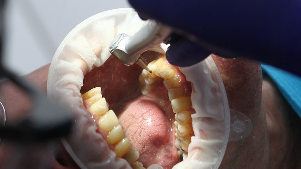 World Oral Health Day theme 2024, Bluegrass Oral Health, Delivering Better Oral Health, Paradigm Oral Health, Miami Bay Oral Health, Oral Health Associates, Oral Health and Heart Disease, Oral Health Assessment Form, Oral Health America, Oral Health and Overall Health, Oral Health Assessment Tool PDF, Oral Health Associates Gallatin TN, Oral Health and Dementia, Oral Health and Diabetes, Oral Health and Pregnancy, Arizona School of Dentistry and Oral Health, AUT Oral Health, Advanced Diploma of Oral Health, Andrew Huberman Oral Health, Advantage Dental Oral Health Center, Advanced Institute for Oral Health, Alcohol and Oral Health, Align Oral Health Suite, Advances in Dentistry and Oral Health, AZ Oral Health Center, Oral Health Brands, Oral Health Benefits, Oral Health Benefits of Coconut Oil, Oral Health Blood Pressure, Oral Health by Country, Oral Health Book, Oral Health Babies, Oral Health Brochure, Oral Health Bacteria, Oral Health Basics, BC College of Oral Health Professionals, Best Probiotics for Oral Health, Bachelor of Oral Health USYD, Bachelor of Oral Health Salary, Boston Center for Oral Health, Bristle Oral Health Test, Bachelor of Oral Health Therapy, Oral Health Center of Delaware, Oral Health Center, Oral Health Care, Oral Health Clinic, Oral Health Council Dog, Oral Health Center Westerville, Oral Health Care Group, Oral Health Coalition, Oral Health Care Oak Park, Oral Health Care of Northern California, CareQuest Institute for Oral Health, Colgate Oral Health Movement, Community Oral Health, Colgate Oral Health Network Login, Community Oral Health Service, Coconut Oil for Oral Health, Central Texas Oral Health, Community Oral Health Officer, College of Oral Health Professionals, Oral Health Day, Oral Health Disparities, Oral Health Definition, Oral Health During Pregnancy, Oral Health Day Meharry, Oral Health Dementia, Oral Health Doctor, Oral Health Dogs, Oral Health Dog Food, Oral Health Dentist, Diabetes and Oral Health, Define Oral Health, Dog Oral Health, Diploma of Oral Health, Dental and Oral Health, DC Oral Health Form, Delivering Better Oral Health DBOH 4th Edition, Dental Research and Oral Health, Diet and Oral Health, Oral Health Education, Oral Health Educator Jobs, Oral Health Equity, Oral Health Effects on Overall Health, Oral Health Exam, Oral Health Education Programs, Oral Health Experts, Oral Health Epidemiology, Oral Health Education Materials, Oral Health Education Topics, Eastman Institute for Oral Health, Enkor D Probiotic for Oral Health, Essential Oils for Oral Health, Effects of Smoking on Oral Health PDF