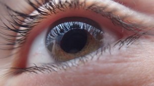 Dementia, dementia meaning, dementia symptoms, dementia treatment, dementia causes, Lewy body dementia, vascular dementia, frontotemporal dementia, early signs of dementia, signs of dementia, dementia disease, dementia and death, dementia and Alzheimer's disease, dementia and amnesia difference, dementia and delirium difference, dementia and delirium, dementia age, dementia age group, dementia and aphasia, dementia assessment, dementia assessment scale, Alzheimer's vs dementia, alcohol-induced dementia, aphasia and dementia, Alzheimer's dementia, amnesia vs dementia, Alzheimer's disease vs dementia, Australia dementia, about dementia disease, Alzheimer's or dementia which is worse, a test for dementia, dementia breakthrough, dementia breakthrough 2024, dementia Bengali meaning, dementia bimari kya hai, dementia brain, dementia bimari kya hoti hai, dementia bimari, dementia bibliography, dementia bedridden life expectancy, dementia blood test, BPSD dementia, blood test dementia, Benadryl and dementia, beginning signs of dementia, body dementia, best foods for dementia patients to eat, brain with dementia, body Lewy dementia, body Lewy dementia stages, best medication for dementia, dementia cure breakthrough, dementia causes death, dementia cure breakthrough 2024, dementia care, dementia cure, dementia care plan, dementia clock, dementia care homes, dementia clinical features, causes of dementia, childhood dementia, can dogs get dementia, can you die from dementia, can cats get dementia, cat dementia, can dementia be cured, can alcohol cause dementia, can dementia be reversed, cognitive test for dementia, dementia definition, dementia death, dementia definition in psychiatry, dementia disease in Hindi, dementia drugs, dementia diagnosis, dementia disease meaning, dementia disorder, dementia definition in mental health nursing, difference between Alzheimer's and dementia, dog dementia, different types of dementia, delirium vs dementia, do statins cause dementia, define dementia, digital dementia, does dementia kill you, definition of dementia, diagnosed with dementia, dementia early symptoms, dementia etiology, dementia examples, dementia exercise, dementia explain, dementia easy definition, dementia end stage, dementia effects, dementia evaluation, dementia explanation, early onset dementia