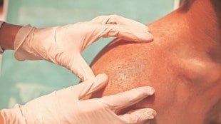 Summer, sun, Sunscreen, Vitamin D, ultraviolet protection factor, UPF, heatwave