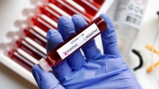 Covid 19 JN 1 Variant Symptoms Cases