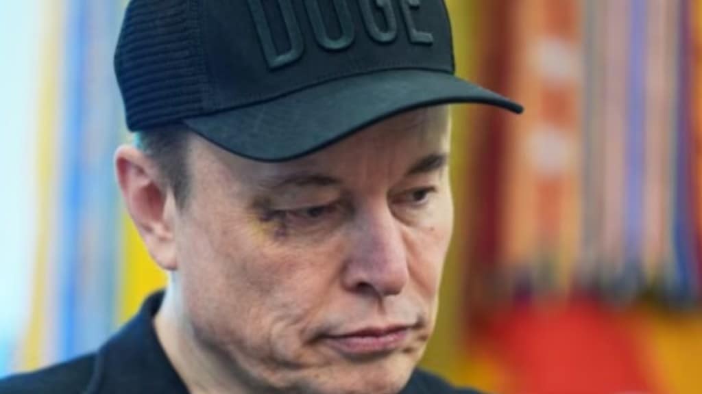 Musk asked, 'what happened to your eye', says I wasn't near the first lady of France Musk asked, 'what happened to your eye', says I wasn't near the first lady of France