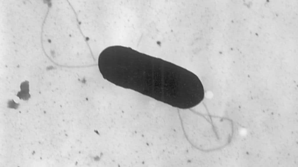 US listeria outbreak