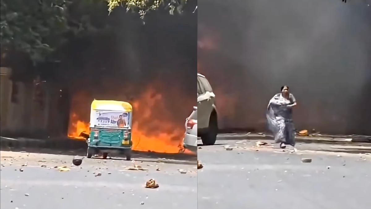 Ahmedabad plane crash: A mother, who was desperately trying to rescue her son who was caught in blaze after Air India flight crashed, has sustained severe burns.