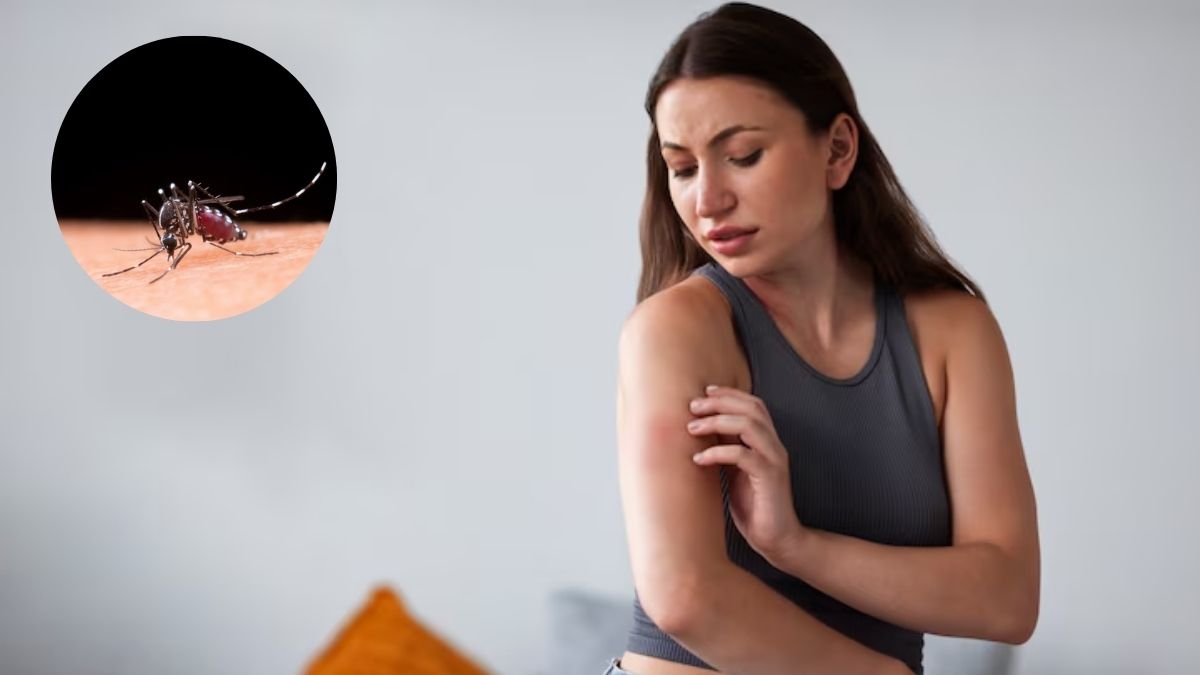 Mosquito-borne diseases due to rains