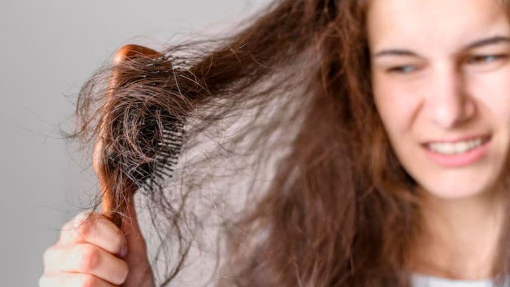 Hair loss in young adults