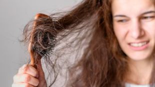 Hair loss in young adults