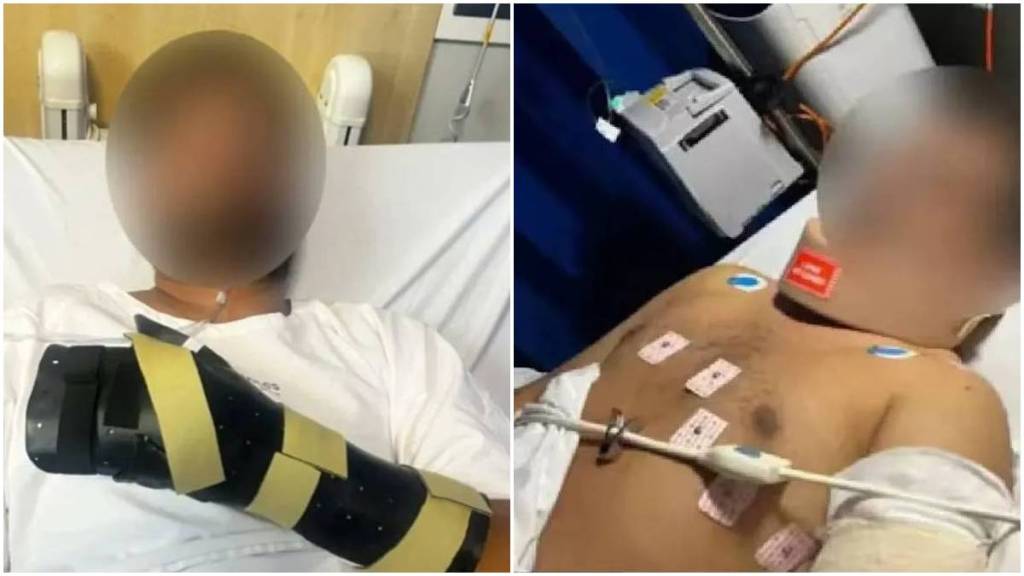 Indian origin man attacked in Australia