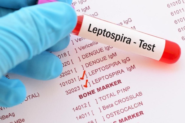 LeptospirosisThis bacterial infection is contracted through contact with water contaminated by the urine of infected animals, particularly rodents. People walking through flooded streets barefoot or with open wounds are highly vulnerable. Leptospirosis can cause high fever, chills, severe muscle aches, vomiting, and redness in the eyes. If untreated, it may lead to liver or kidney damage. (Image: Pexels)
