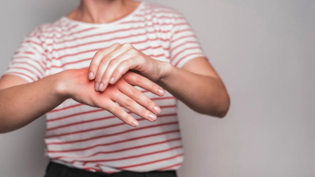 Fatty liver signs on hands
