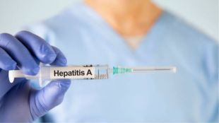 Hepatitis A and E outbreak in Delhi