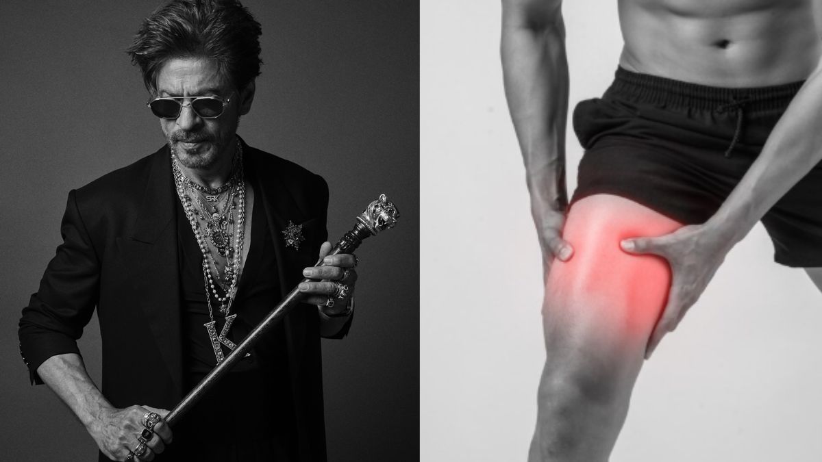 Shah Rukh Khan muscle injury