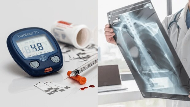  Number of cases: India reported an estimated 3.15 lakh TB-related deaths in 2024. accounting for 29 per cent of the deaths globally. The burden of diabetes is also consistently increasing in the country, with over 100 million people currently living with the disease. (Photo Source: Canva)
