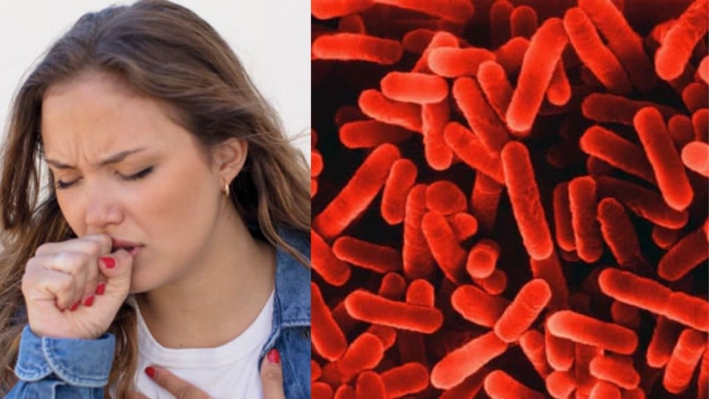 What is legionnaires disease? Two dead, 58 affected in Harlem over the spread of this bacterial infection What is legionnaires disease? Two dead, 58 affected in Harlem over the spread of this bacterial infection
