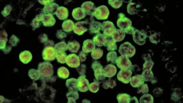 The amoeba infects people when it enters their body through the nose, causing a rapid and severe inflammation of the brain.