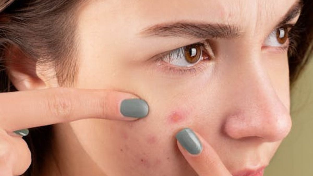 Skin problems due to Vitamin D deficiency